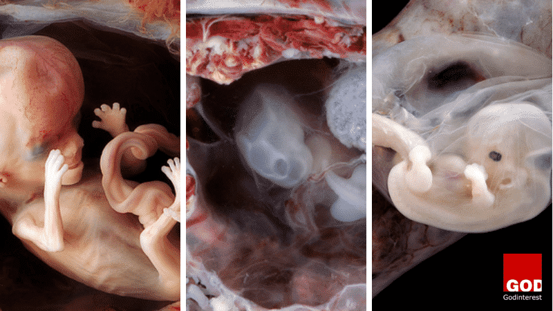 Stunning Photos of Babies in Womb Expose Pro-Abortionists lie About Human Development.